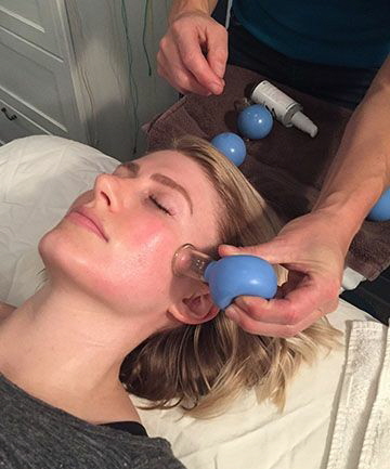 Cupping Facial